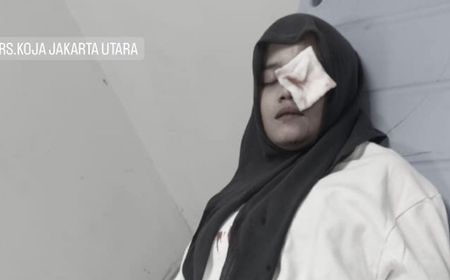 wanita-cantik-dipukul-komplotan-remaja-di-kali-sunter,-kelopak-matanya-robek-kena-pecahan-kaca