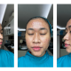 ‘tak-keluar-rumah-dan-nangis-tiap-malam’-cerita-acne-fighter-susah-payah-bangun-percaya-diri