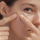 kenapa-jerawat-susah-hilang-padahal-sudah-pakai-skincare?